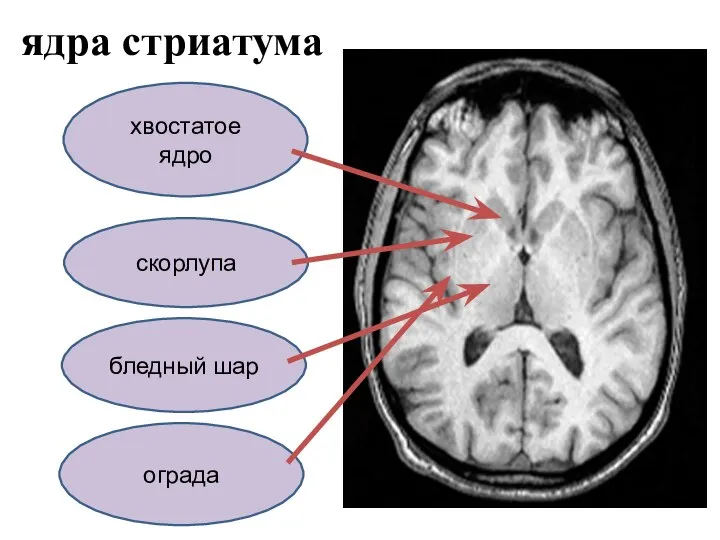 ядра стриатума хвостатое ядро бледный шар скорлупа ограда