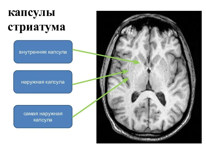 капсулы стриатума самая наружная капсула наружная капсула внутренняя капсула