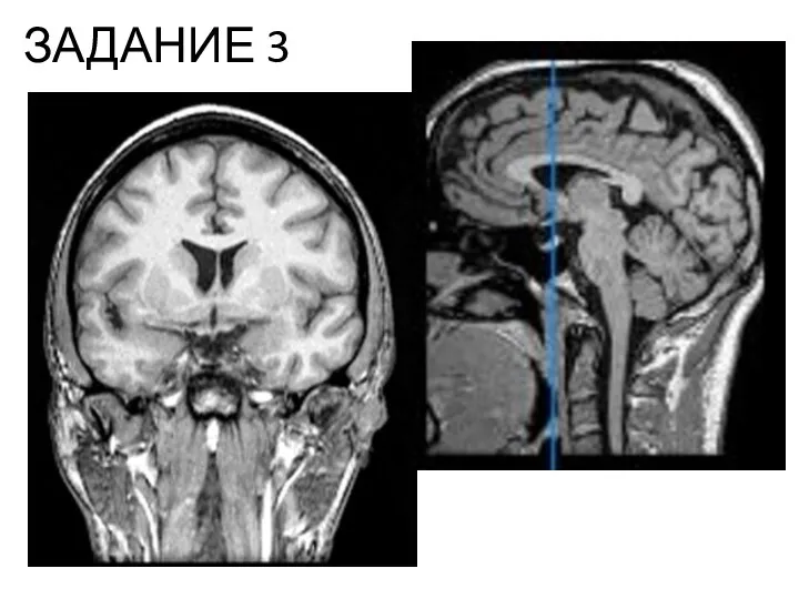 ЗАДАНИЕ 3