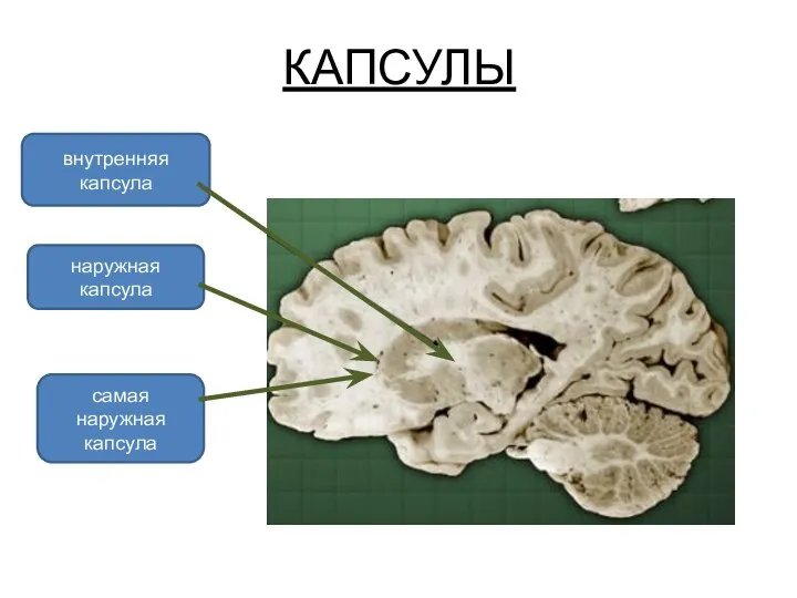 КАПСУЛЫ внутренняя капсула наружная капсула самая наружная капсула