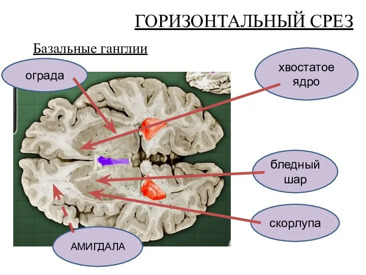 ГОРИЗОНТАЛЬНЫЙ СРЕЗ хвостатое ядро ограда АМИГДАЛА бледный шар скорлупа Базальные ганглии