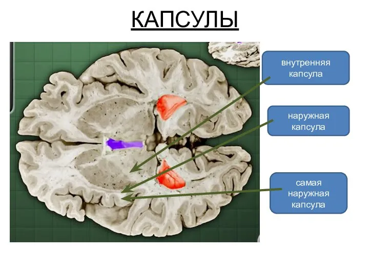 КАПСУЛЫ внутренняя капсула наружная капсула самая наружная капсула