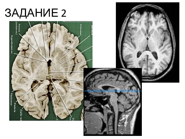 ЗАДАНИЕ 2