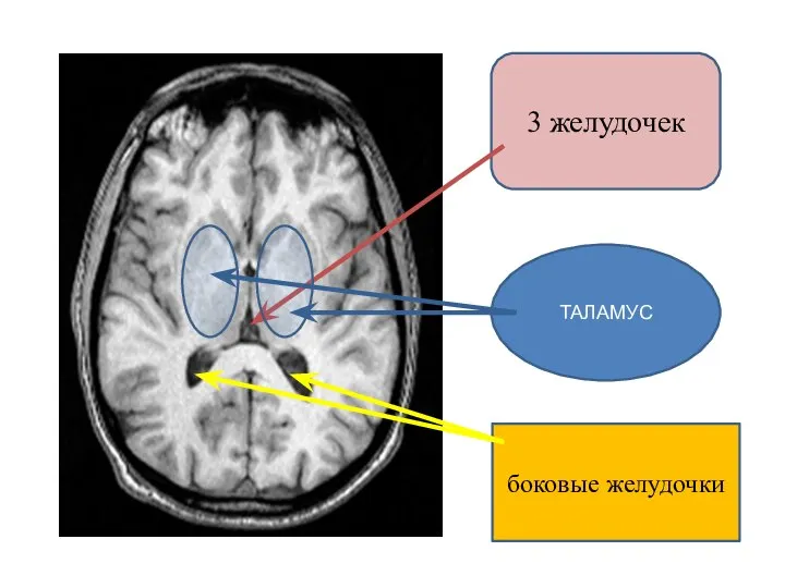 3 желудочек ТАЛАМУС боковые желудочки