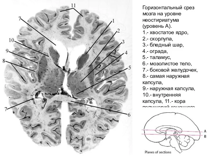 Горизонтальный срез мозга на уровне неостириатума (уровень А). 1.- хвостатое ядро,