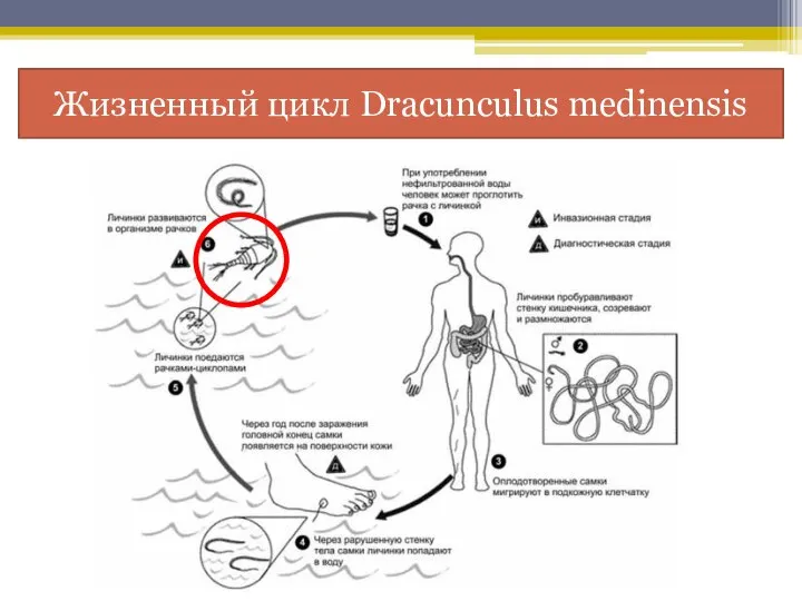 Жизненный цикл Dracunculus medinensis