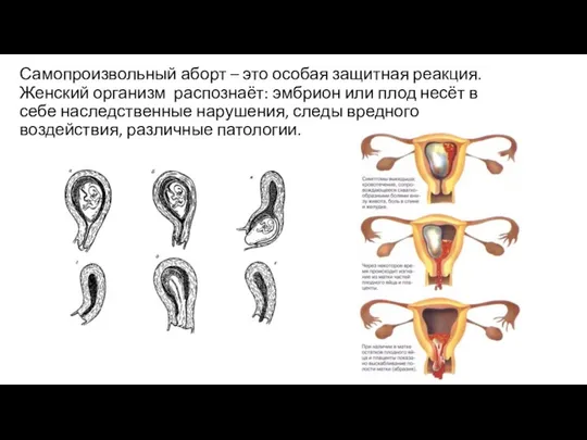 Самопроизвольный аборт – это особая защитная реакция. Женский организм распознаёт: эмбрион