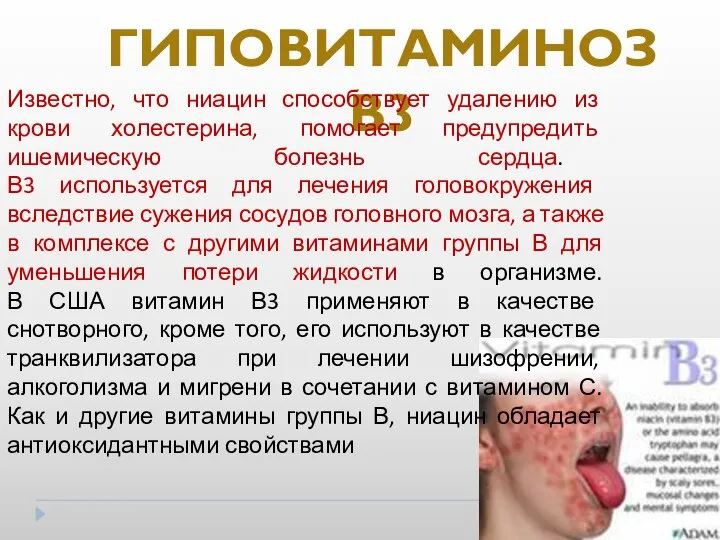 ГИПОВИТАМИНОЗ В3 Известно, что ниацин способствует удалению из крови холестерина, помогает