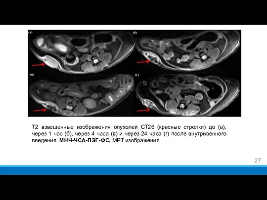 Т2 взвешенные изображения опухолей CT26 (красные стрелки) до (а), через 1