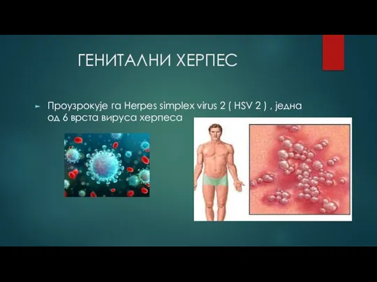 ГЕНИТАЛНИ ХЕРПЕС Проузрокује га Herpes simрlex virus 2 ( HSV 2