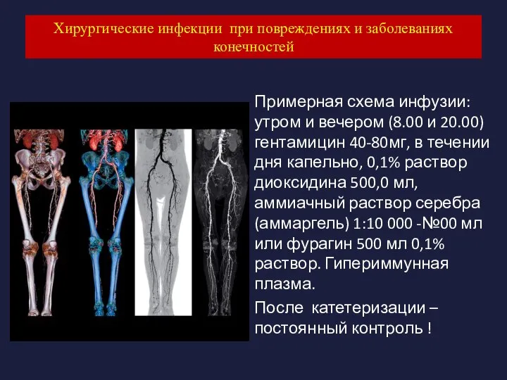 Хирургические инфекции при повреждениях и заболеваниях конечностей Примерная схема инфузии: утром