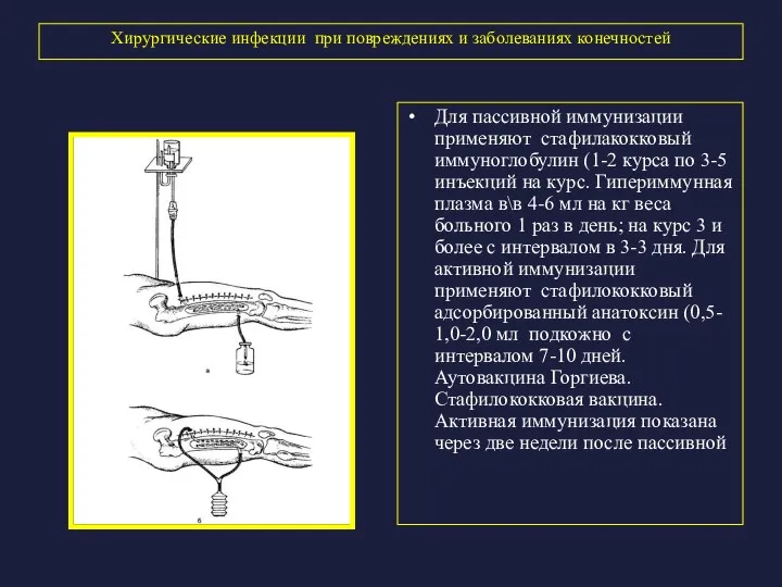 Хирургические инфекции при повреждениях и заболеваниях конечностей Для пассивной иммунизации применяют