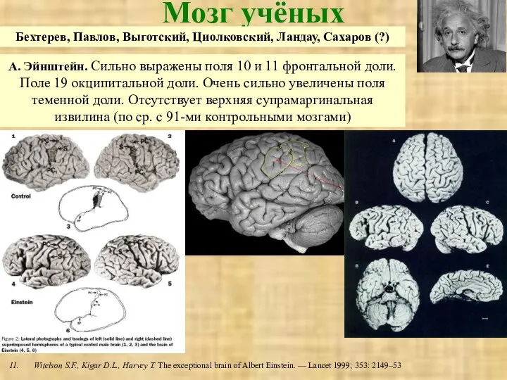 Мозг учёных А. Эйнштейн. Сильно выражены поля 10 и 11 фронтальной