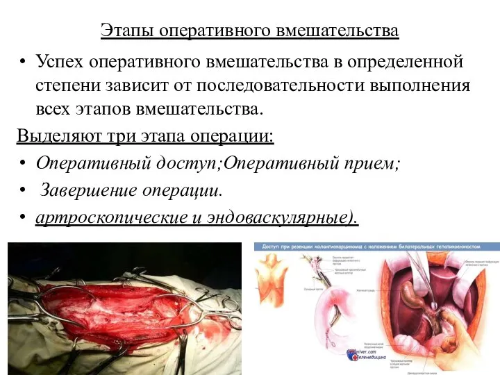 Этапы оперативного вмешательства Успех оперативного вмешательства в определенной степени зависит от