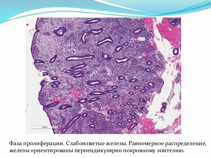 Фаза пролиферации. Слабоизвитые железы. Равномерное распределение, железы ориентированы перпендикулярно покровному эпителию.