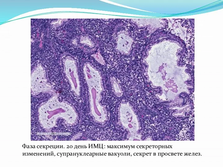 Фаза секреции. 20 день ИМЦ: максимум секреторных изменений, супрануклеарные вакуоли, секрет в просвете желез.