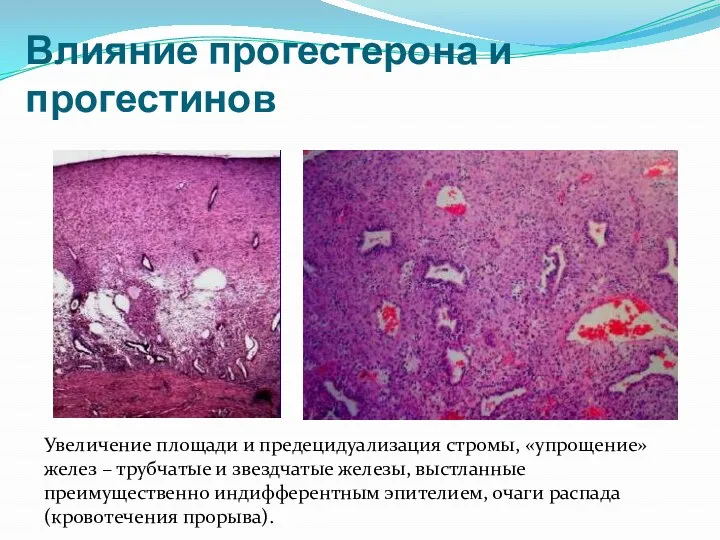 Влияние прогестерона и прогестинов Увеличение площади и предецидуализация стромы, «упрощение» желез