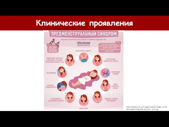 Клинические проявления https://www.amic.ru/images/upload/images_11-2018/images/infografika-zdorove---pms.jpg