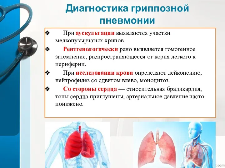 Диагностика гриппозной пневмонии При аускультации выявляются участки мелкопузырчатых хрипов. Рентгенологически рано