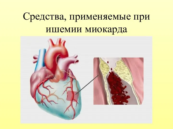 Средства, применяемые при ишемии миокарда