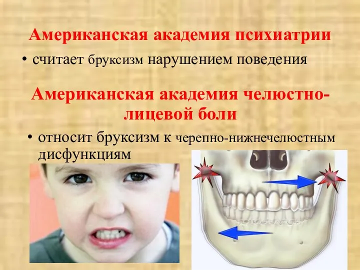 Американская академия психиатрии считает бруксизм нарушением поведения Американская академия челюстно-лицевой боли относит бруксизм к черепно-нижнечелюстным дисфункциям