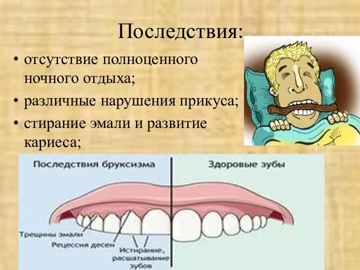 Последствия: отсутствие полноценного ночного отдыха; различные нарушения прикуса; стирание эмали и развитие кариеса;