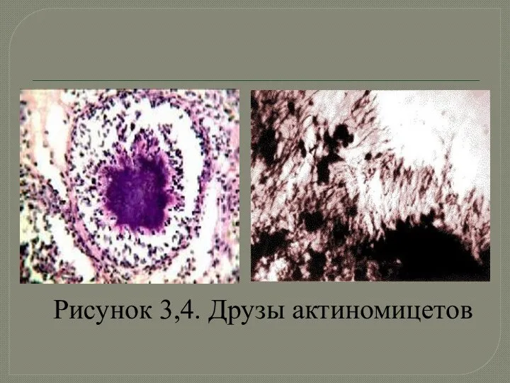 Рисунок 3,4. Друзы актиномицетов