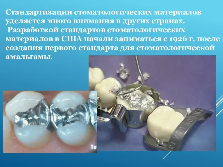 Стандартизации стоматологических материалов уделяется много внимания в других странах. Разработкой стандартов