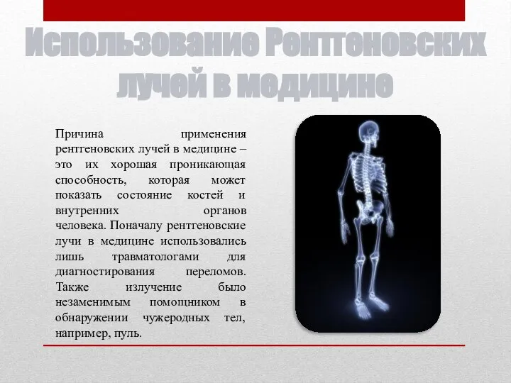 Использование Рентгеновских лучей в медицине Причина применения рентгеновских лучей в медицине