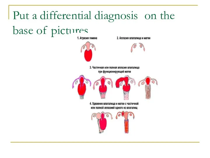 Put a differential diagnosis on the base of pictures.