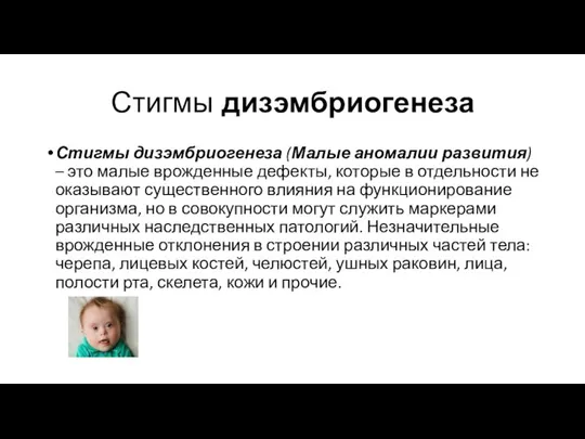 Стигмы дизэмбриогенеза (Малые аномалии развития) – это малые врожденные дефекты, которые