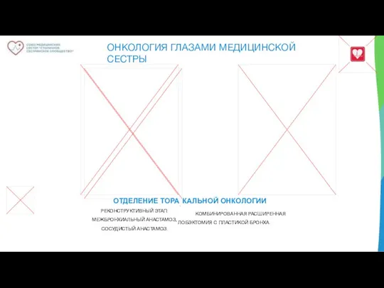 ОНКОЛОГИЯ ГЛАЗАМИ МЕДИЦИНСКОЙ СЕСТРЫ ОТДЕЛЕНИЕ ТОРА. КАЛЬНОЙ ОНКОЛОГИИ РЕКОНСТРУКТИВНЫЙ ЭТАП: КОМБИНИРОВАННАЯ