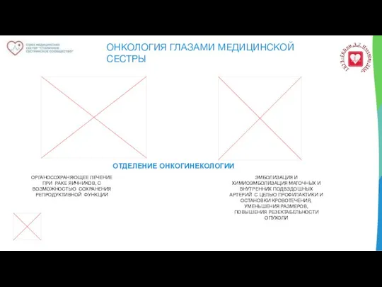 ОНКОЛОГИЯ ГЛАЗАМИ МЕДИЦИНСКОЙ СЕСТРЫ ОТДЕЛЕНИЕ ОНКОГИНЕКОЛОГИИ ОРГАНОСОХРАНЯЮЩЕЕ ЛЕЧЕНИЕ ПРИ РАКЕ ЯИЧНИКОВ,