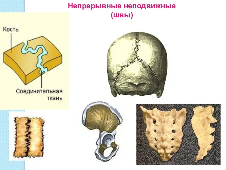 Непрерывные неподвижные (швы)