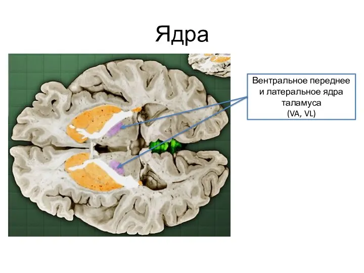 Ядра Вентральное переднее и латеральное ядра таламуса (VA, VL)