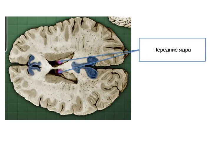 Передние ядра