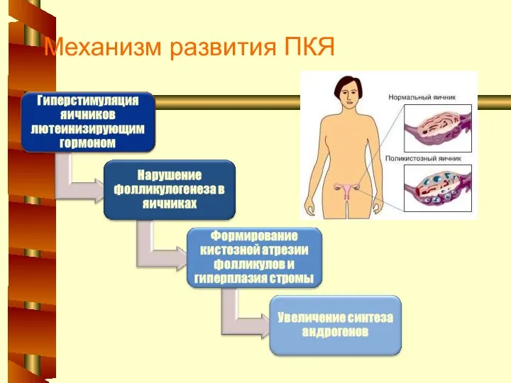 Механизм развития ПКЯ