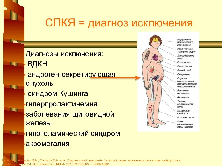 СПКЯ = диагноз исключения Диагнозы исключения: ВДКН андроген-секретирующая опухоль синдром Кушинга