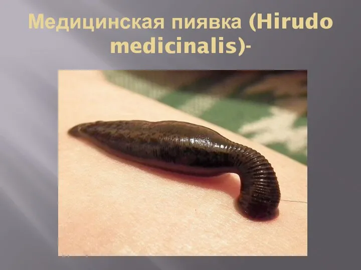 Медицинская пиявка (Hirudo medicinalis)-
