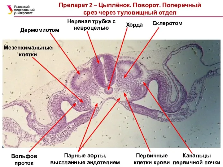 Препарат 2 – Цыплёнок. Поворот. Поперечный срез через туловищный отдел Нервная