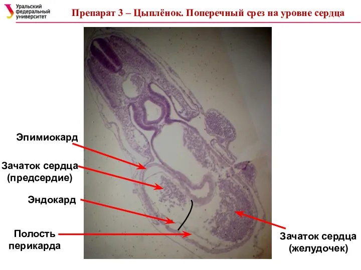 Эпимиокард Эндокард Зачаток сердца (предсердие) Зачаток сердца (желудочек) Полость перикарда Препарат