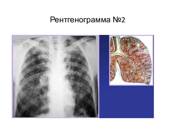 Рентгенограмма №2