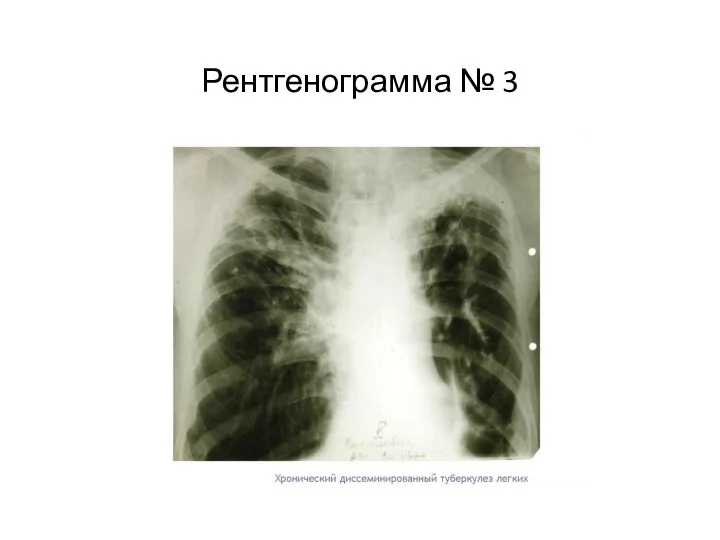 Рентгенограмма № 3