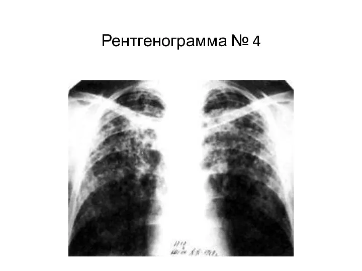 Рентгенограмма № 4