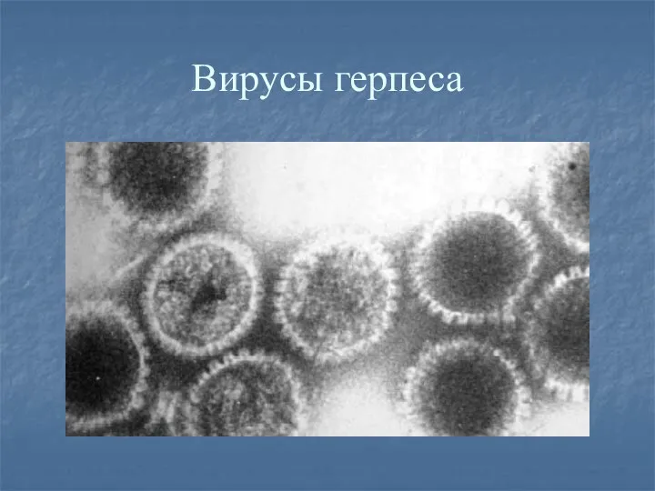 Вирусы герпеса