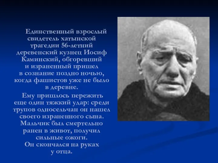 Единственный взрослый свидетель хатынской трагедии 56-летний деревенский кузнец Иосиф Каминский, обгоревший