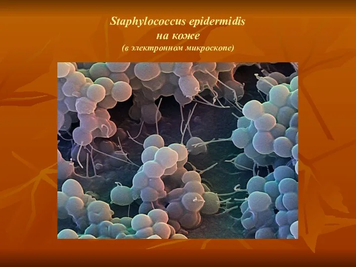 Staphylococcus epidermidis на коже (в электронном микроскопе)