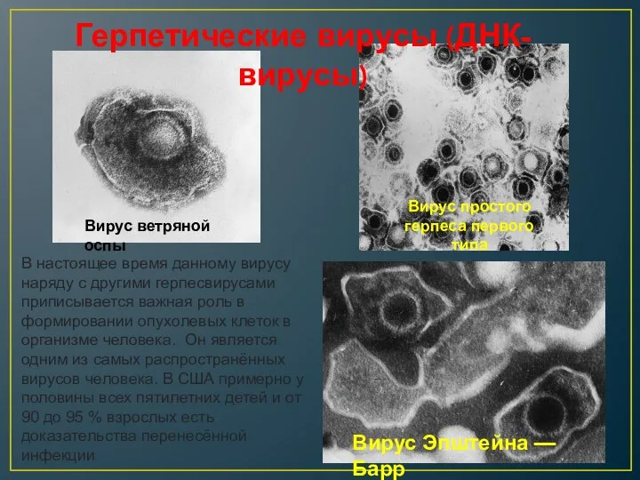 Вирус ветряной оспы Вирус простого герпеса первого типа Вирус Эпштейна —