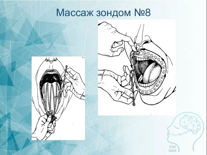 Массаж зондом №8