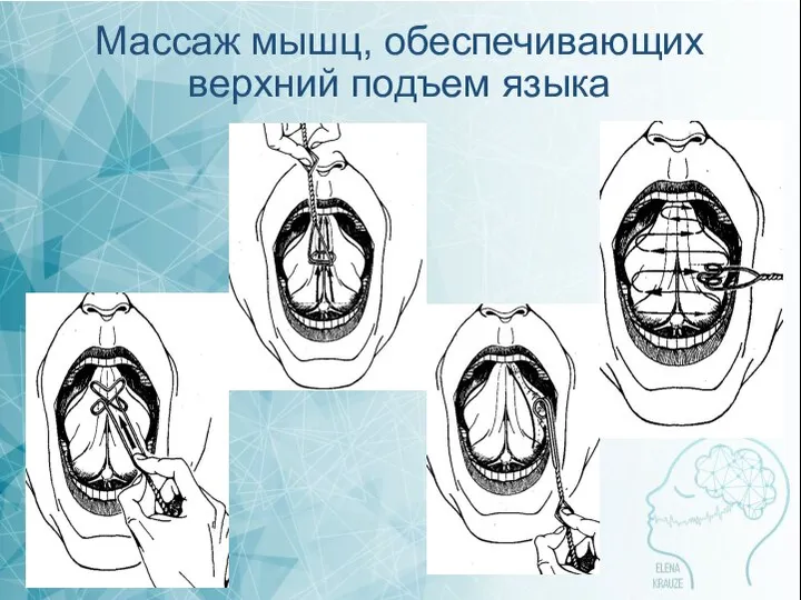 Массаж мышц, обеспечивающих верхний подъем языка